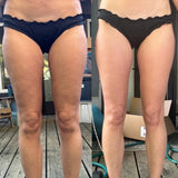 Altrique™ - Anti-Cellulite Massager